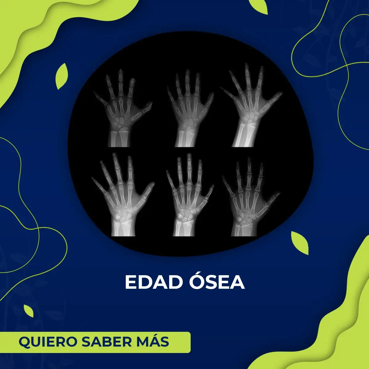 banner edad osea Banner de edad osea