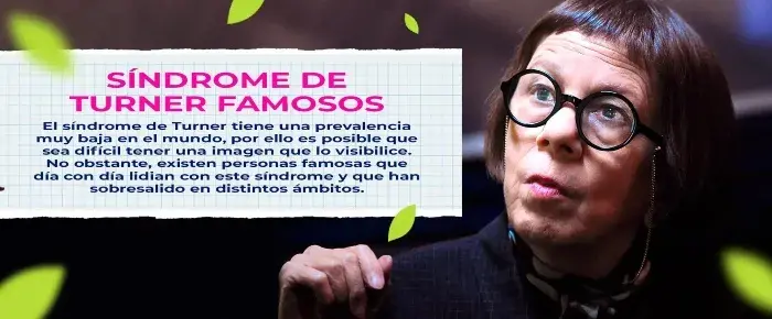 Famosas con síndrome de Turner que han sobresalido en distintos ámbitos.