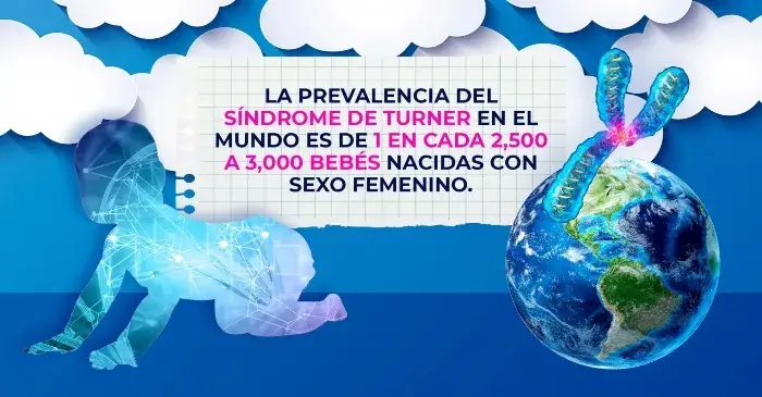 La prevalencia del síndrome de Turner es de 1 en cada 2,500