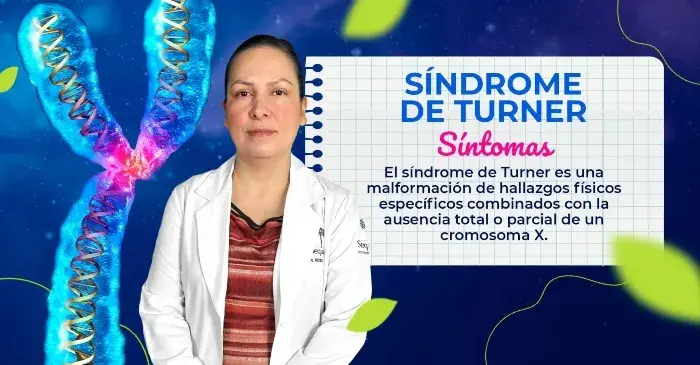 El síndrome de Turner es una malformación genética con variados síntomas físicos.