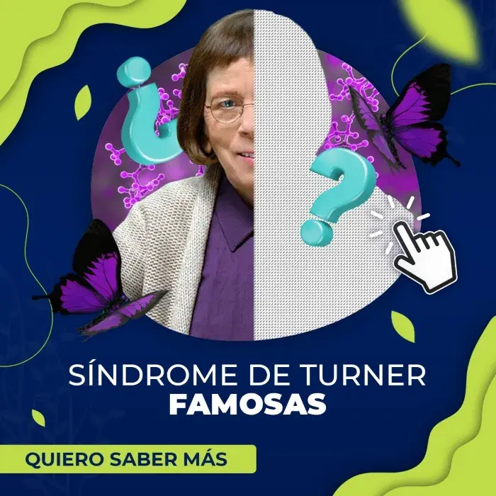 Famosos con sindrome de Turner