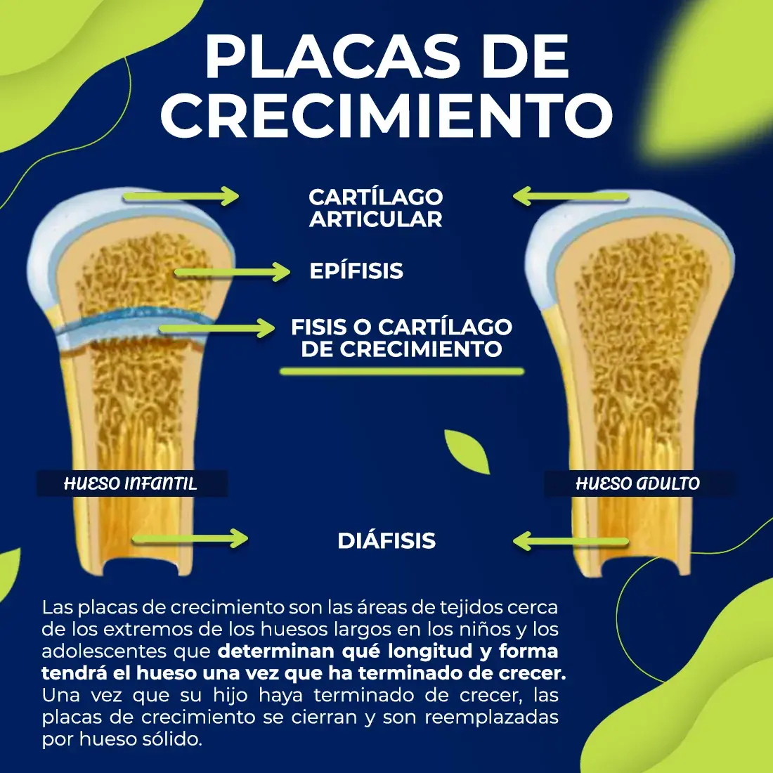 Las placas de crecimiento son las áreas de tejidos cerca de los huesos.