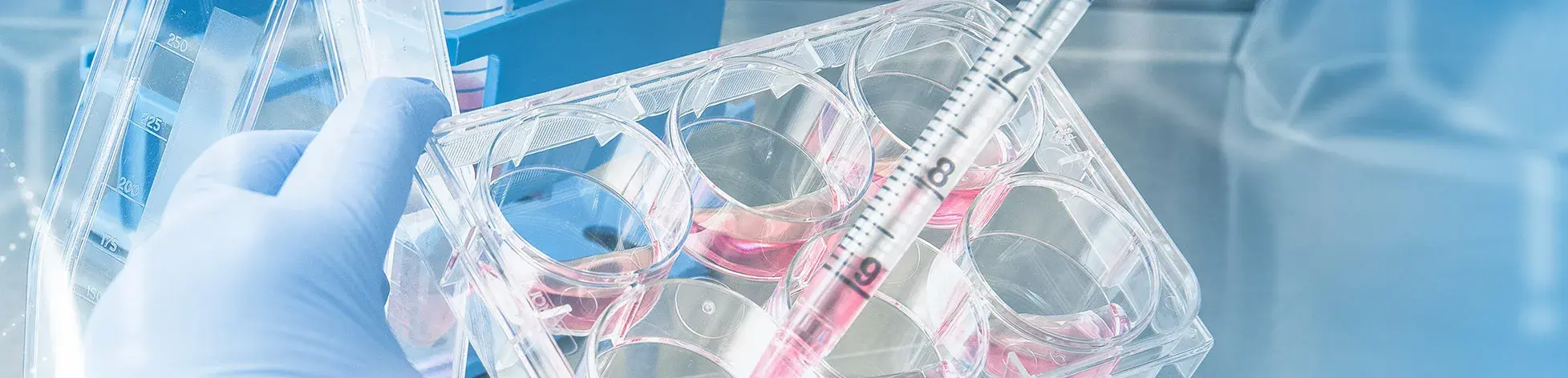 Botón que lleva a Síndrome de Turner diagnostico